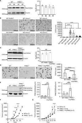 Loss of PTEN-Induced Kinase 1 Regulates Oncogenic Ras-Driven Tumor Growth By Inhibiting Mitochondrial Fission